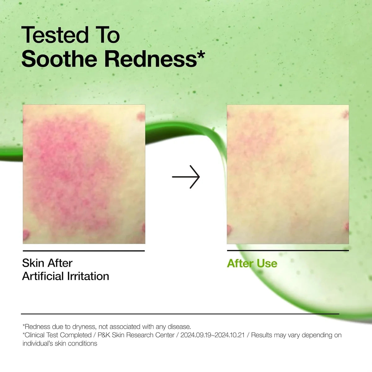 Anua Niacinamide TXA Serum